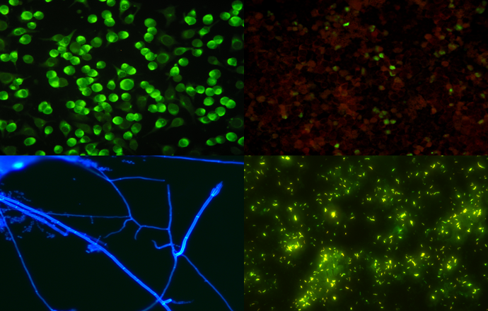 Immunofluorescence imaging under mshot microscope