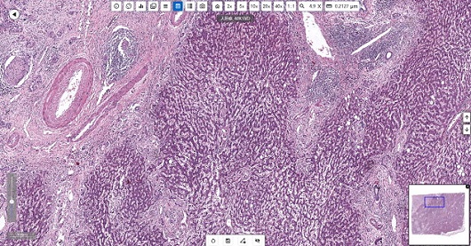 Application of Microscopes in Pathology Laboratories of CDC application01