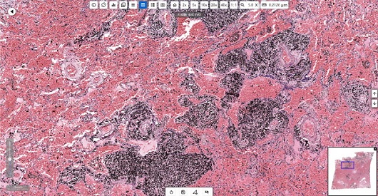 Application of Microscopes in Pathology Laboratories of CDC application02