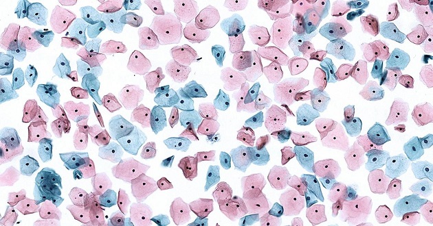 Application of Microscopes in Pathology Laboratories of CDC application03