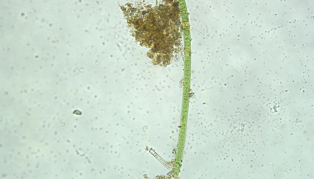 Application of Microscopic Imaging in Algae Research 01