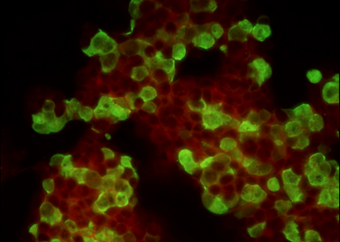 Respiratory Tract Multiplex Assay