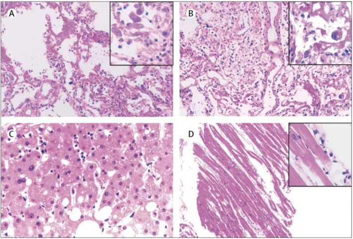 Virus Scouts — Unveiling the Application of Microscopes in Virus Laboratories of CDC application02
