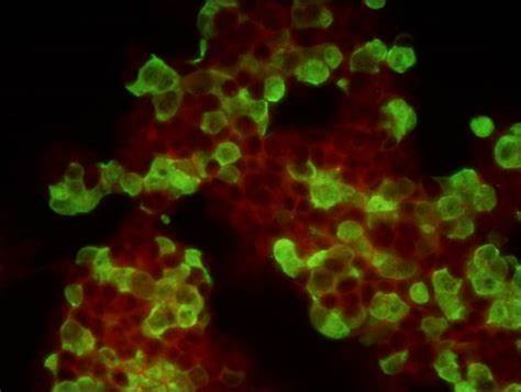 Virus Scouts — Unveiling the Application of Microscopes in Virus Laboratories of CDC application03