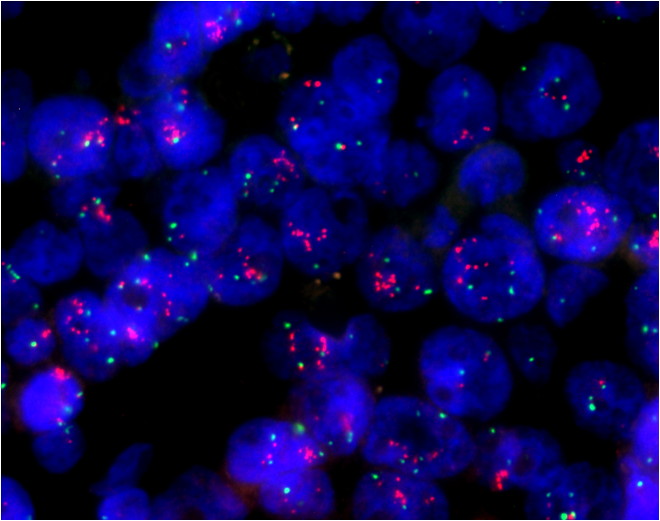 Virus Scouts — Unveiling the Application of Microscopes in Virus Laboratories of CDC application04