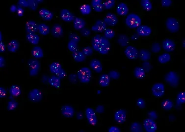 Fluorescence In Situ Hybridization (FISH)