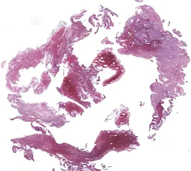 图片-1.png11-1 (1)