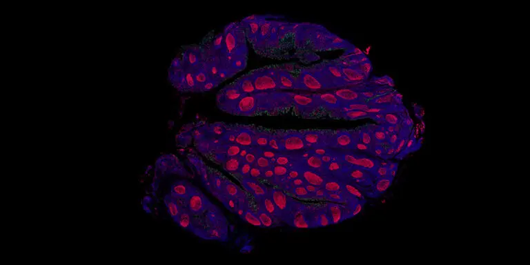 Immunohistochemistry (IHC)