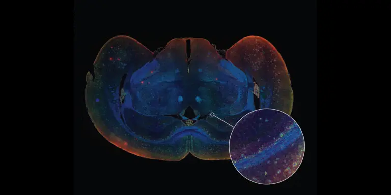 Immunofluorescence Mouse Brain Slices