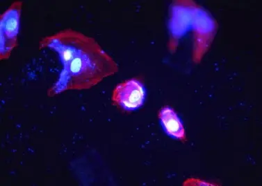 Live Cell Imaging