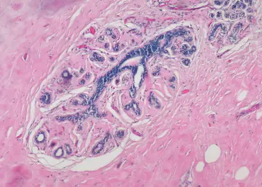 Pathological lmaging